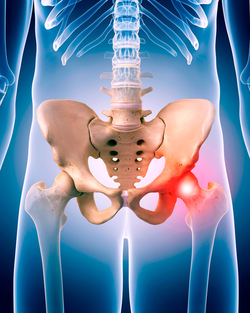 "Human hip pain